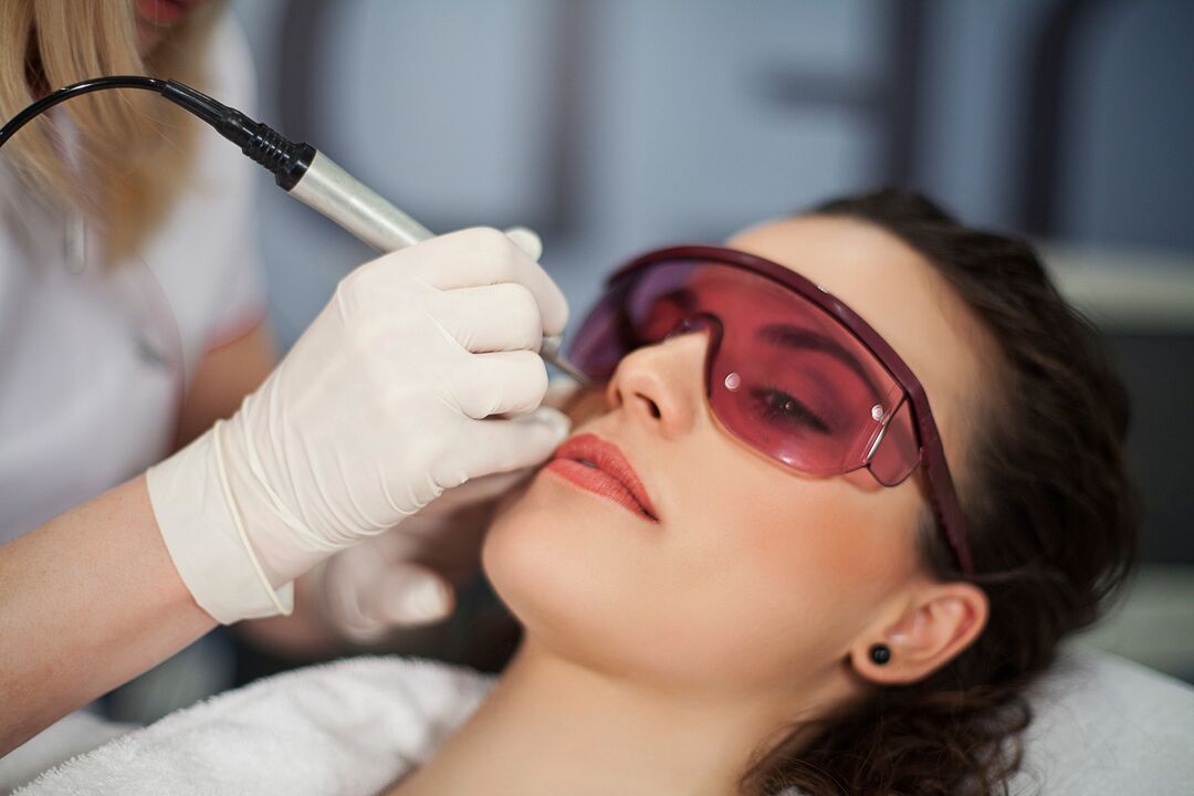 Tophorèse laser pour le rajeunissement de la peau