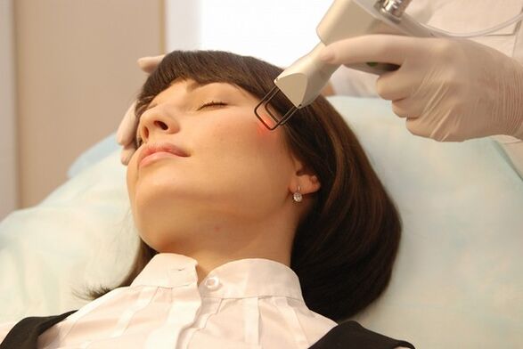 Laser pour le rajeunissement