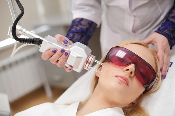 Rajeunissement au laser du visage