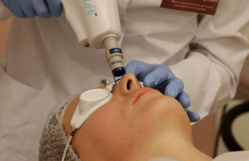 Rajeunissement laser non résolu